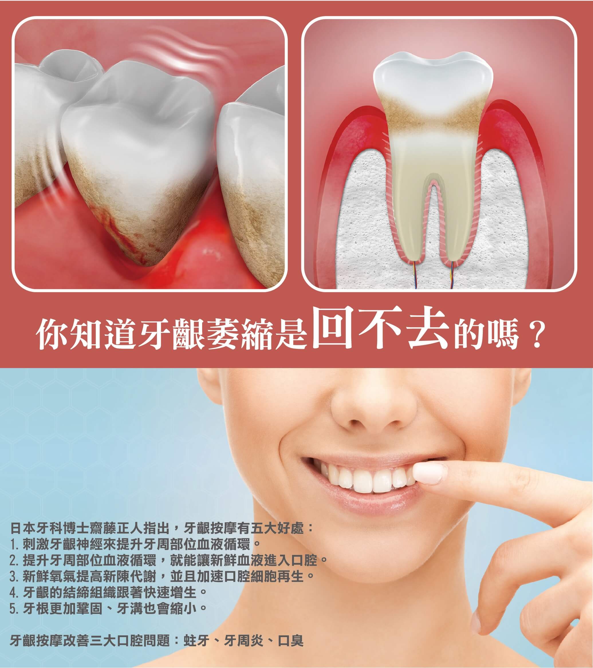 牙齦萎縮無法復原