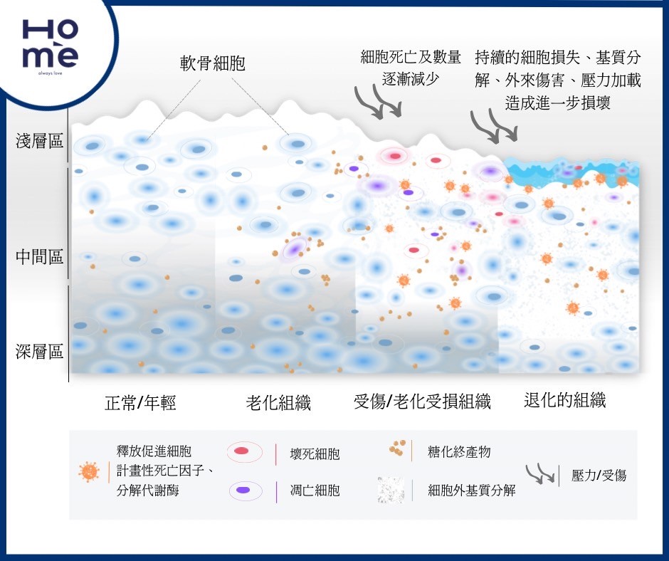 [HoMe小學堂] 關節卡卡? 軟骨到底是什麼?