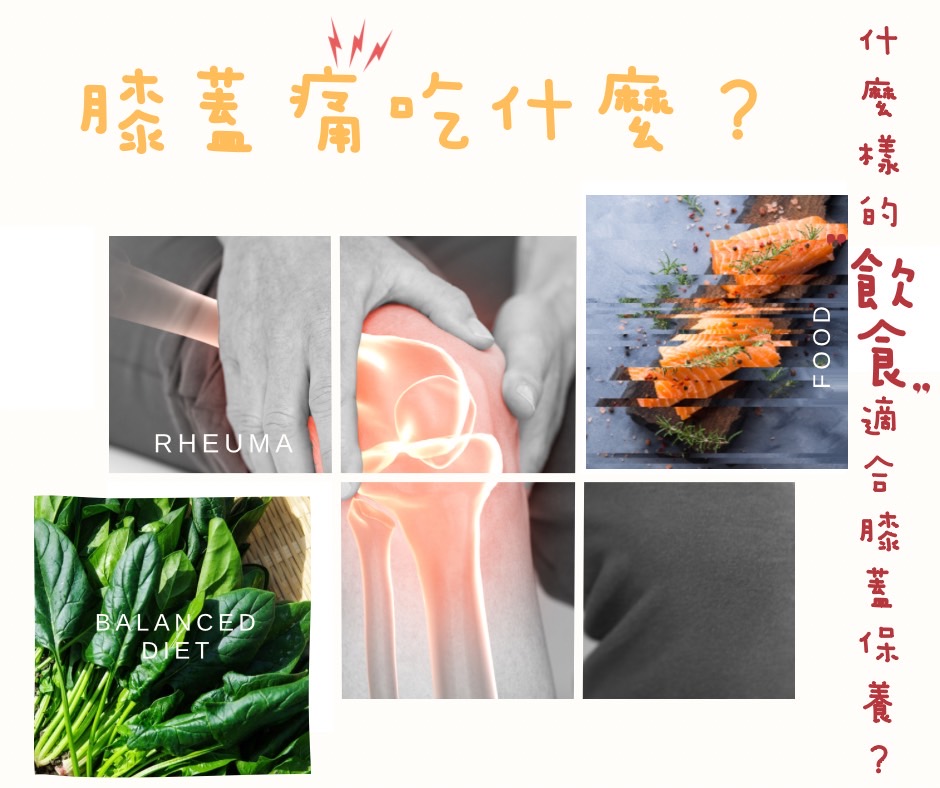 膝蓋痛吃什麼? 什麼樣的飲食適合膝蓋保養呢? (重點筆記)