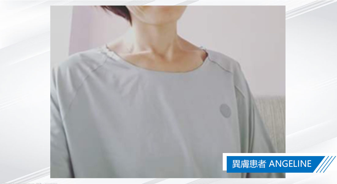 【異膚病友協會~試穿體驗】整體來說，水研衣非常舒適，它的親膚程度極佳！