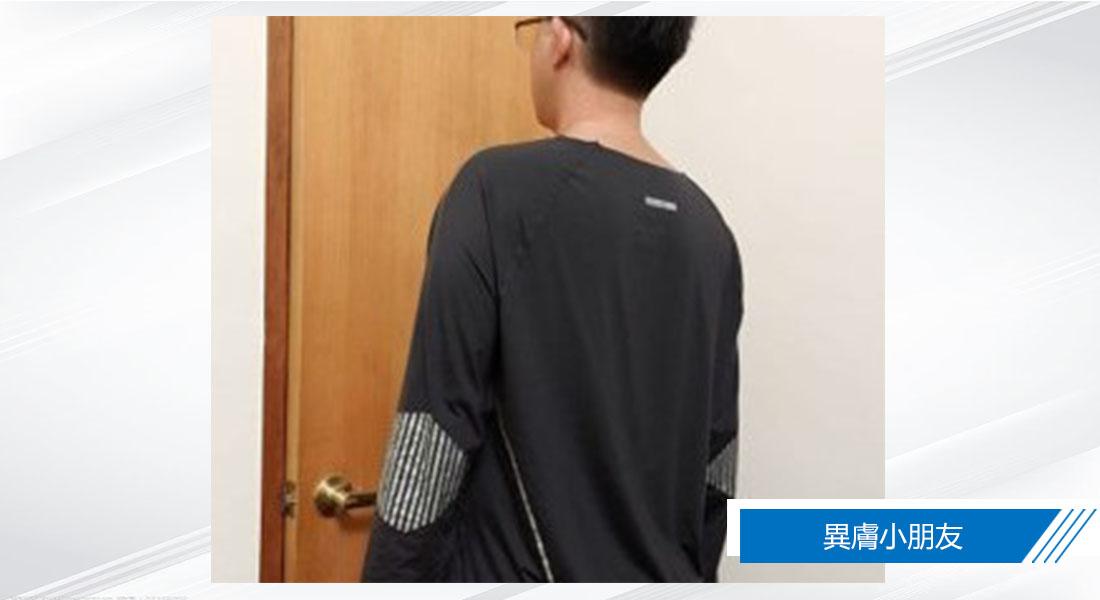 【異膚病友協會~試穿體驗】水研衣 減少睡覺時搔抓還有悶熱流汗的情形