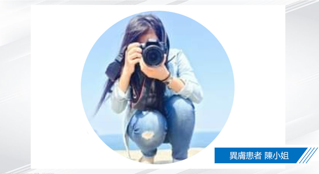 【異膚病友協會~試穿體驗】水研衣真的是很瞭解異膚半夜睡覺忍不住抓癢的習慣