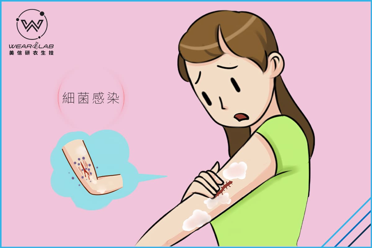 秋冬正是皮膚銀屑病的易發時間，哪些症狀說明你有銀屑病呢？