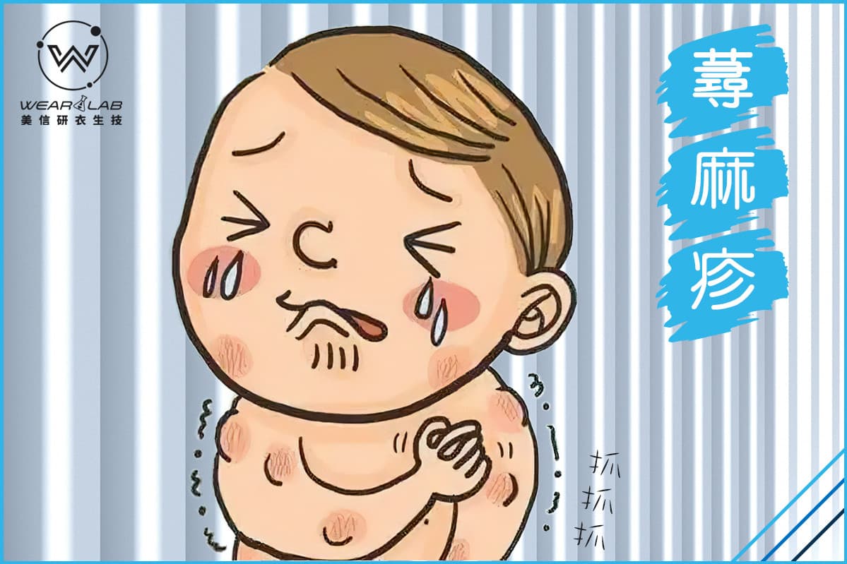 蕁麻疹發作，幾個簡單的快速止癢方法