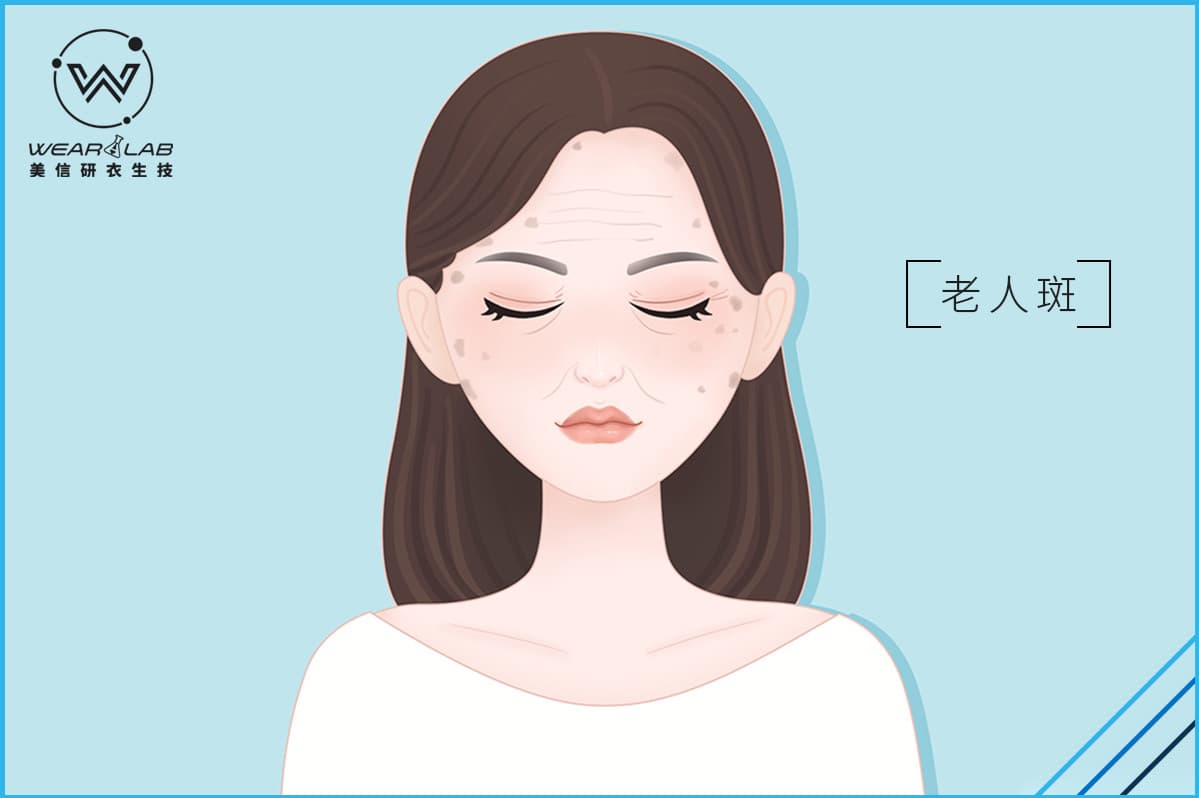 預防老人斑，做好4件事很重要！