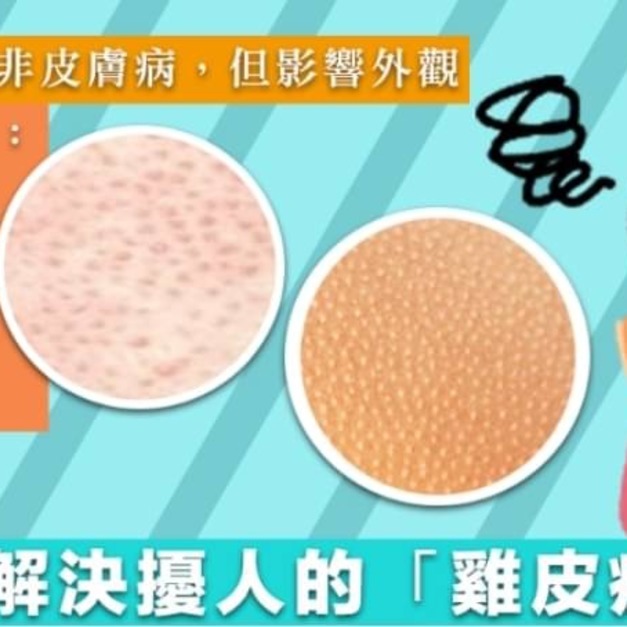 EdaChic AmLactin 12%果酸身體乳567g