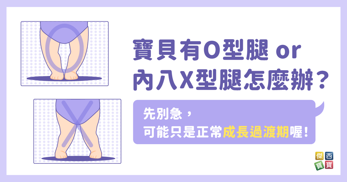 寶貝有O型腿或內八X型腿怎麼辦？先別急，可能只是正常成長過渡期喔！