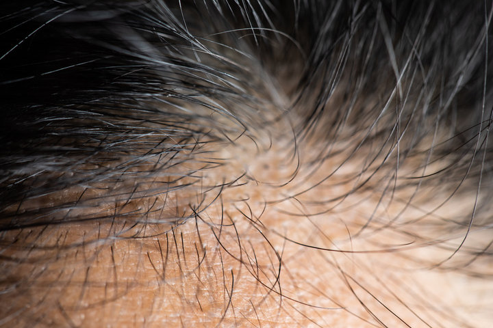 「總類黃酮、芸香苷、檞皮素」：養髮液中的黃金鐵三角。