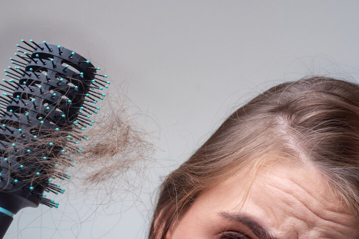 掉髮怎麼辦？揭開導致現代人掉髮的7個壞習慣，你中了幾個？