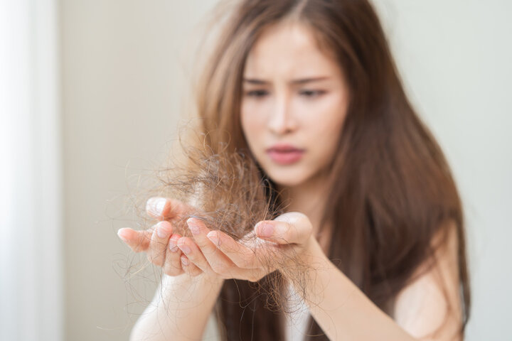 節食、不當減肥，如何造成「休止期掉髮」？瘦了身形卻賠了髮量？營養師教你 3 招「頭皮補給術」，讓美麗不打折