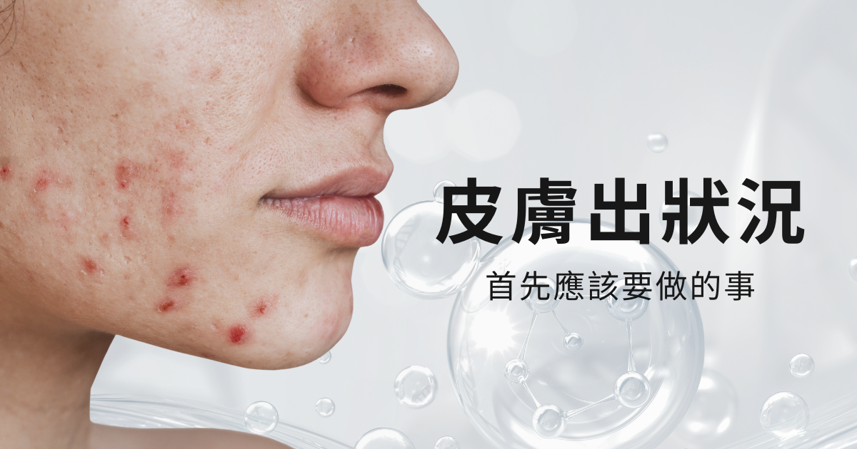 IFS影響因子｜臉好像爛掉了，我該怎麼辦？