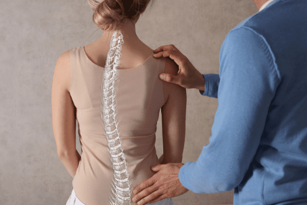 脊椎側彎示意圖