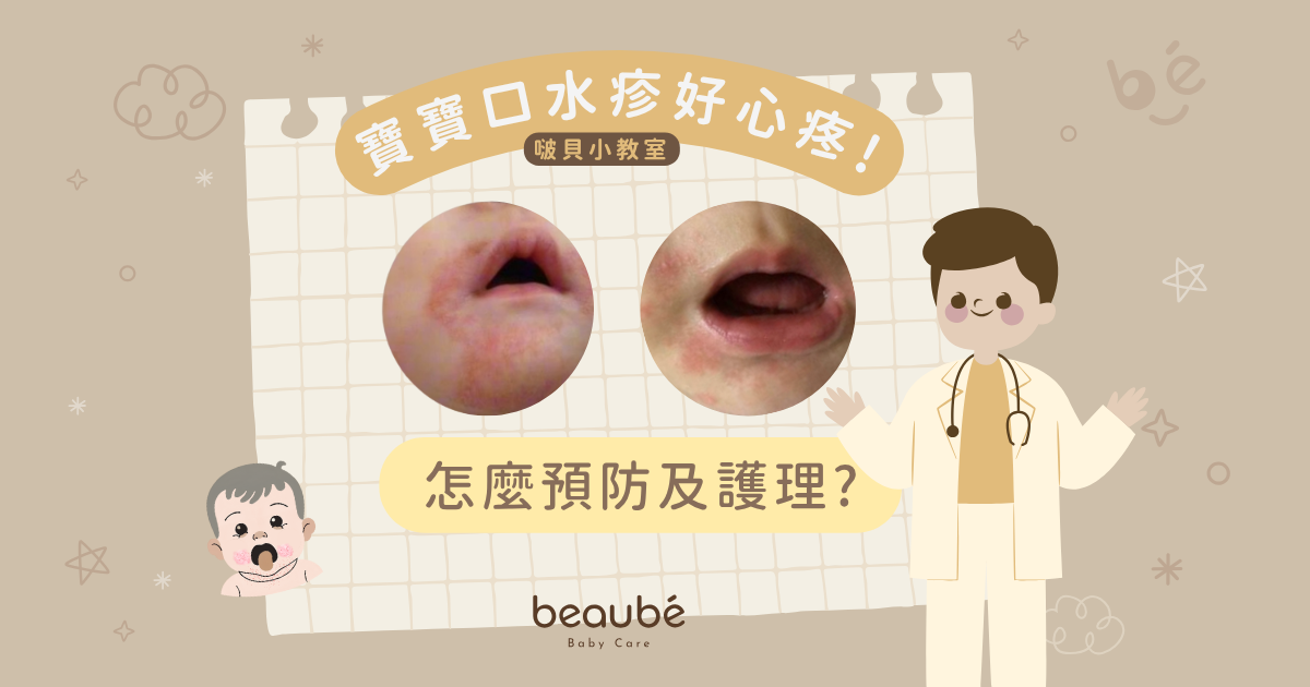 寶寶口水疹好心疼！如何預防＆護理？
