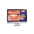 exocad DentalCAD 基礎方案_1