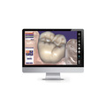 exocad DentalCAD 基礎方案_2