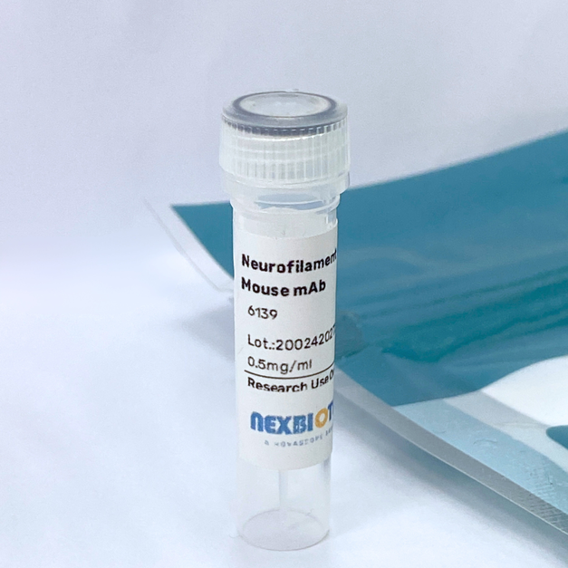 Neurofilament light (NFL) Mouse mAb (#)