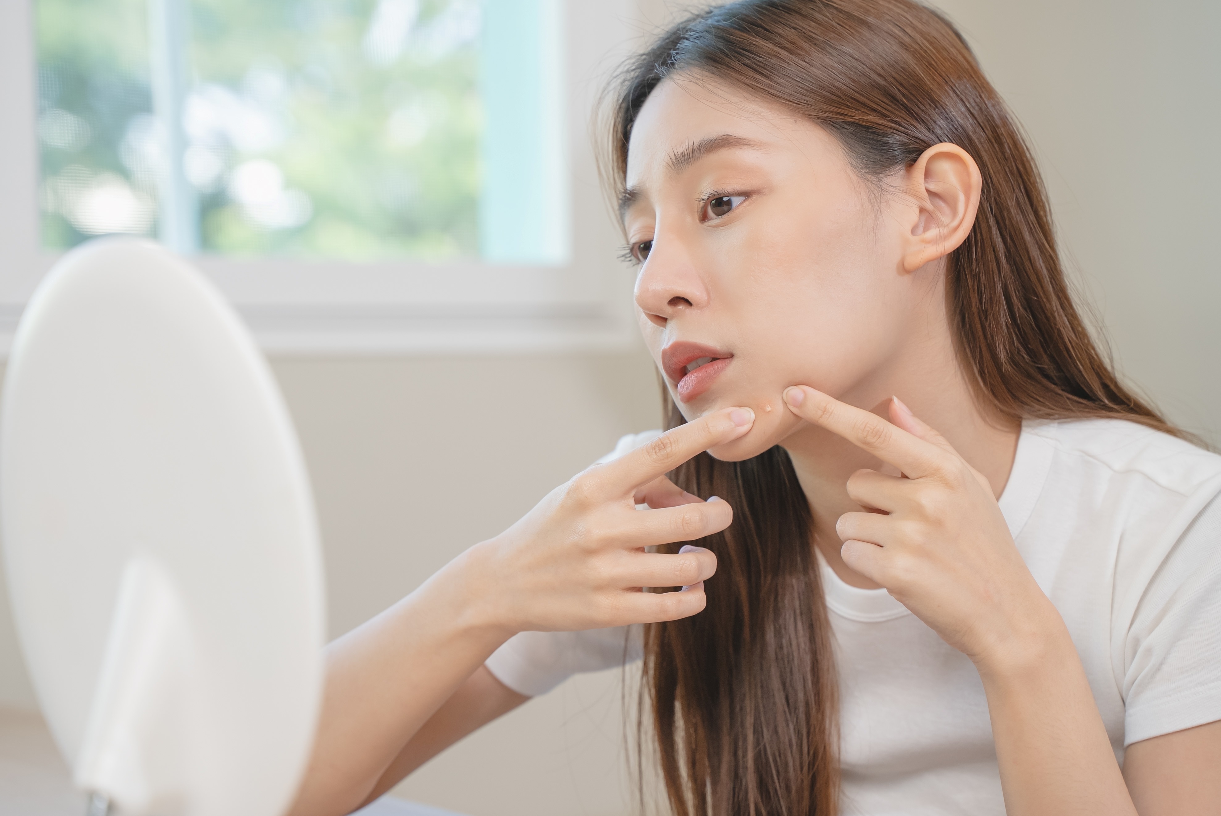 你擠的是粉刺嗎？粉刺種類這樣分!