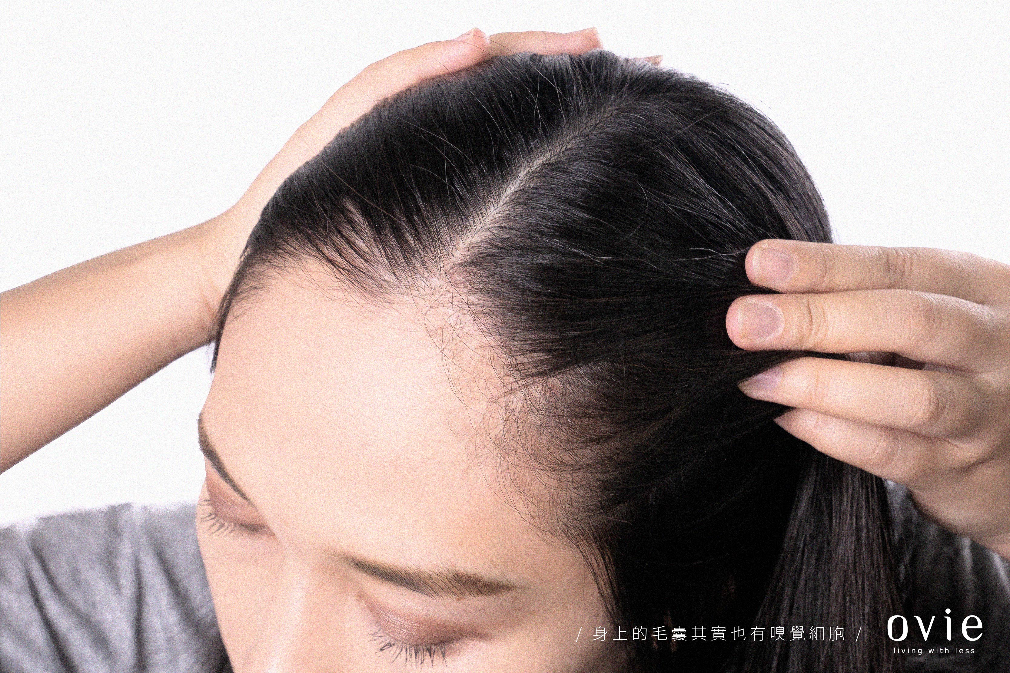 髮際線高怎麼辦