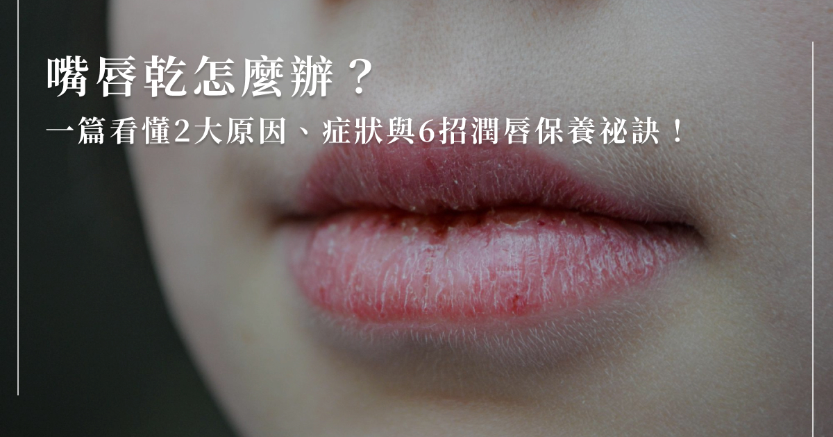 嘴唇乾怎麼辦？一篇看懂2大原因、症狀與6招潤唇保養祕訣！