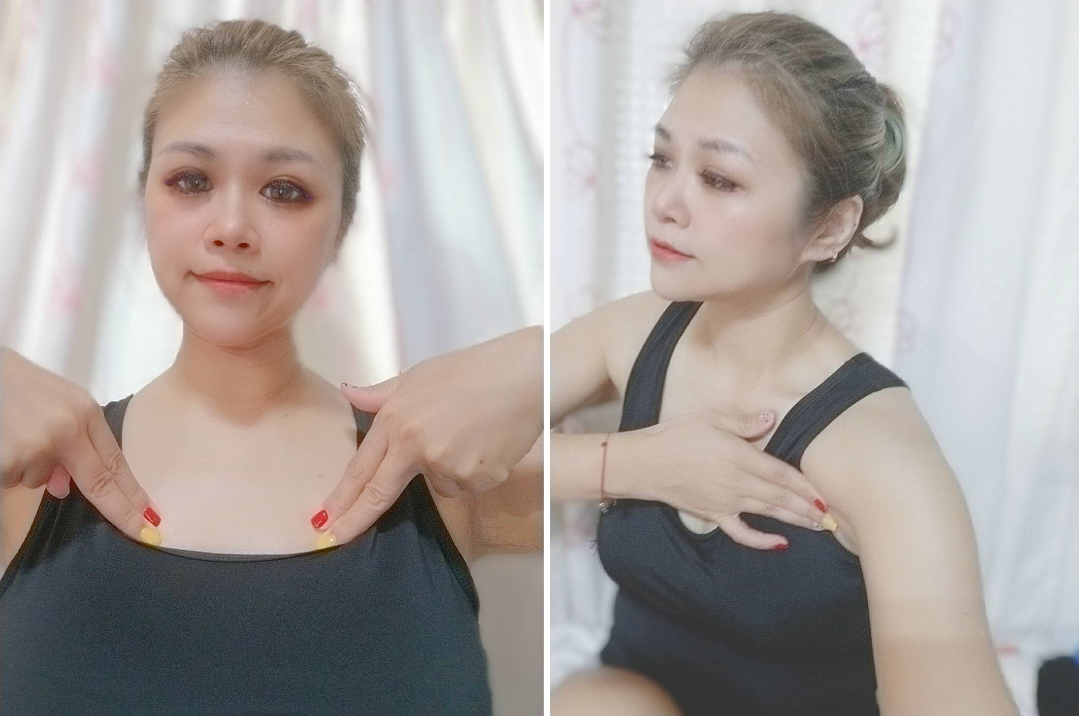 許多產後媽媽都有胸部下垂布袋奶困擾