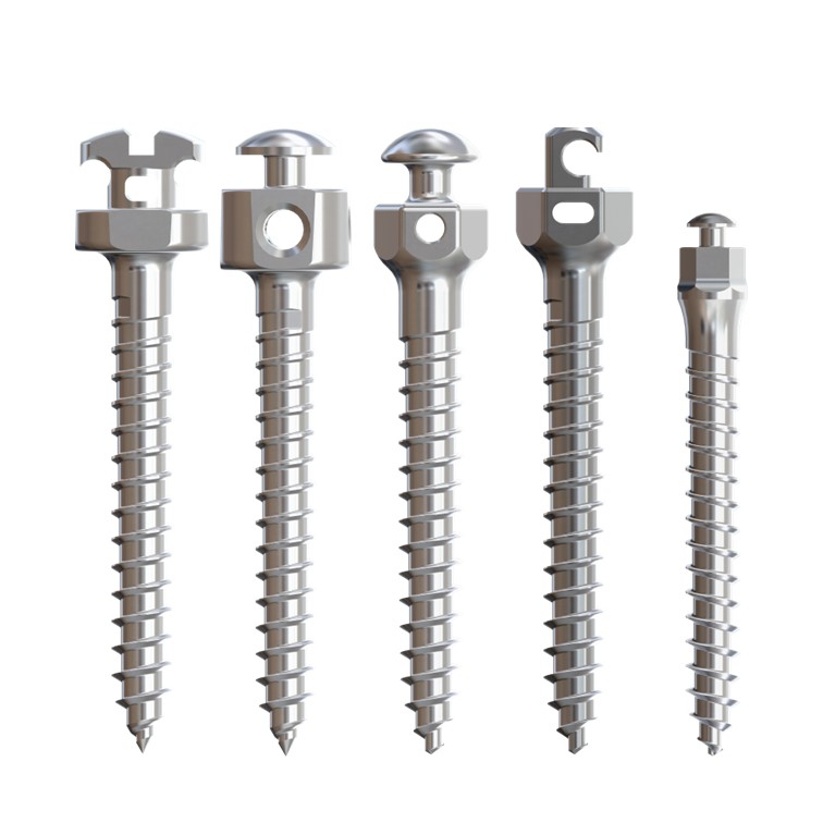 矯正釘選鈦合金還是不鏽鋼？一文看懂醫材材質差異與臨床選擇關鍵