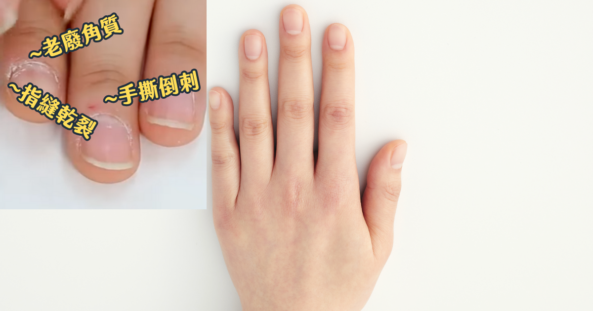 自己在家DIY便宜超多!居家護甲組讓手指柔嫩亮澤✨
