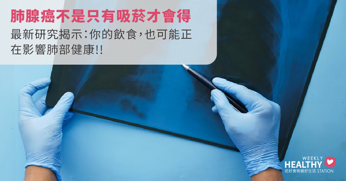 肺腺癌是什麼？「沉默殺手」的5大警訊、成因、飲食關聯與預防方法一次看！